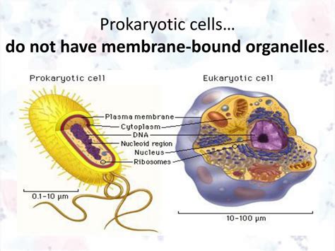 A Prokaryotic Cell Does Not Have