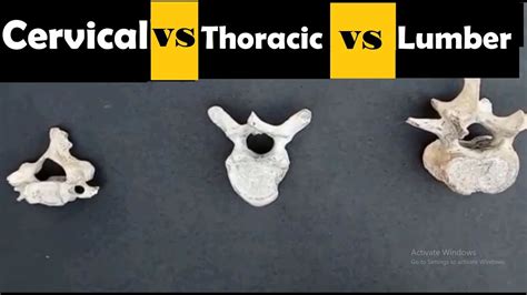 Difference Between Cervical Lumbar And Thoracic Vertebrae