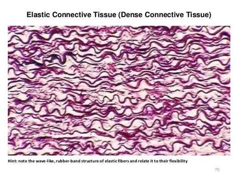 Elastic Connective Tissue Is Found In