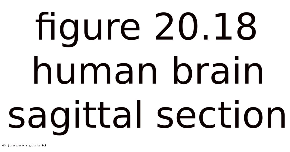 Figure 20.18 Human Brain Sagittal Section