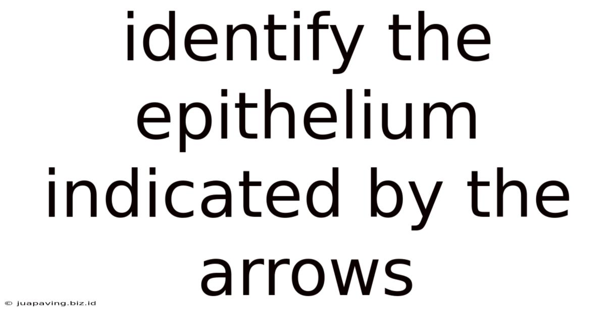 Identify The Epithelium Indicated By The Arrows