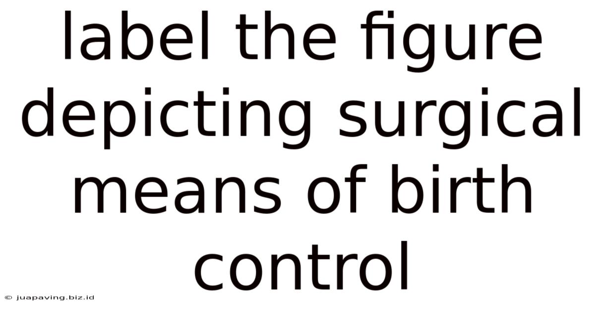 Label The Figure Depicting Surgical Means Of Birth Control