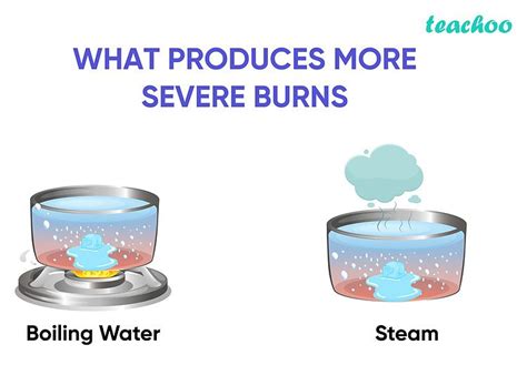 Steam Produces More Severe Burns Than Boiling Water