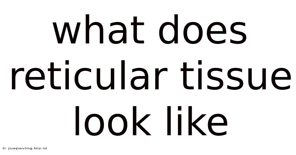 What Does Reticular Tissue Look Like